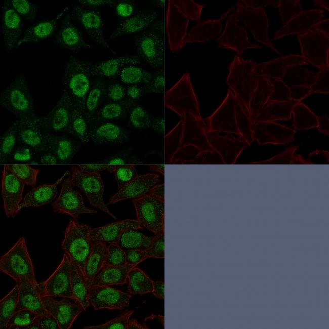 Topoisomerase II alpha (Proliferation and Drug-Resistance Marker) Antibody in Immunocytochemistry (ICC/IF)