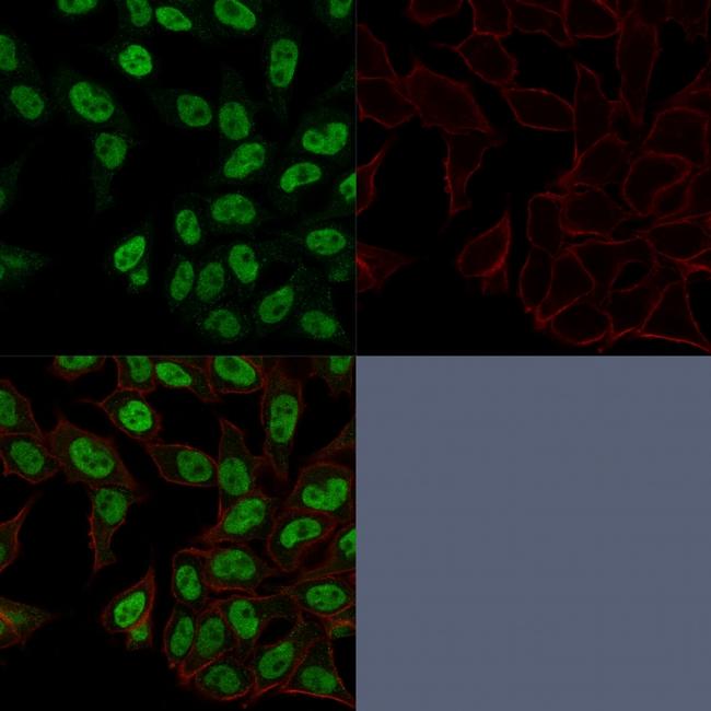 Topoisomerase II alpha Antibody in Immunocytochemistry (ICC/IF)