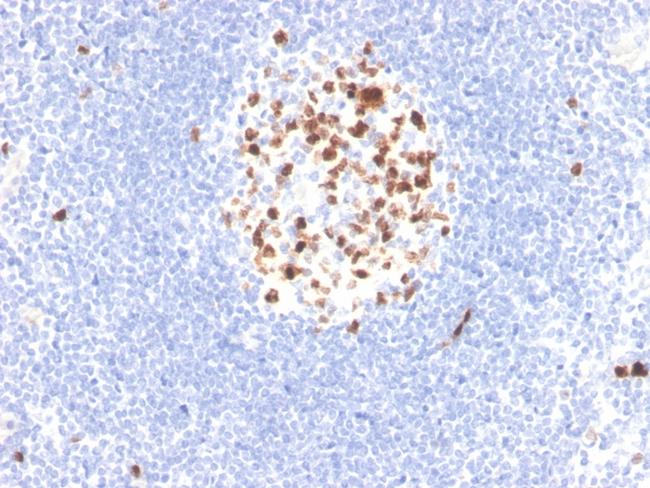 Topoisomerase II alpha (Proliferation and Drug-Resistance Marker) Antibody in Immunohistochemistry (Paraffin) (IHC (P))