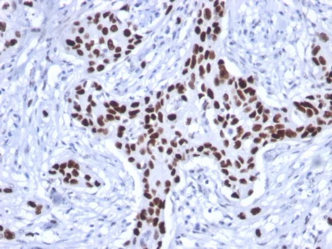 p53 Tumor Suppressor Protein Antibody in Immunohistochemistry (Paraffin) (IHC (P))