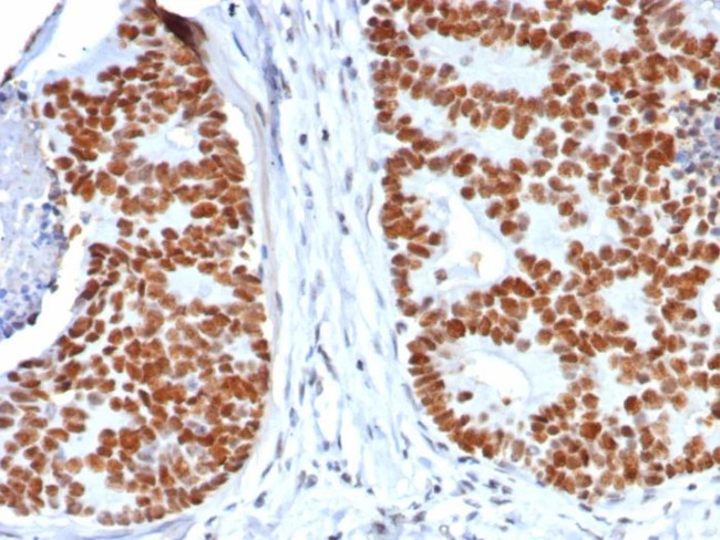 p53 Tumor Suppressor Protein Antibody in Immunohistochemistry (Paraffin) (IHC (P))