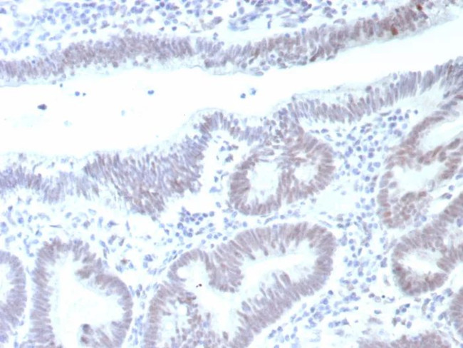 p53 (Tumor Suppressor Protein) Antibody in Immunohistochemistry (Paraffin) (IHC (P))