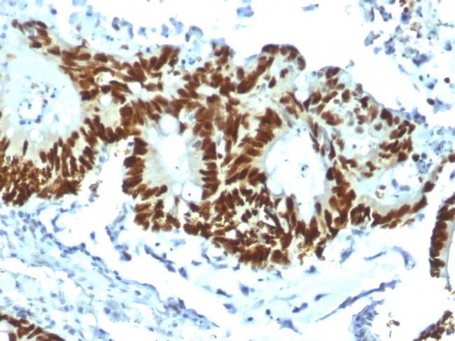 p53 Tumor Suppressor Protein Antibody in Immunohistochemistry (Paraffin) (IHC (P))