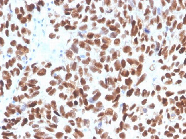 p53 (Tumor Suppressor Protein) Antibody in Immunohistochemistry (Paraffin) (IHC (P))