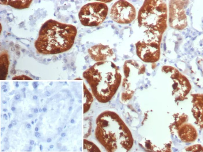 TPH1/Tryptophan Hydroxylase 1 Antibody in Immunohistochemistry (Paraffin) (IHC (P))