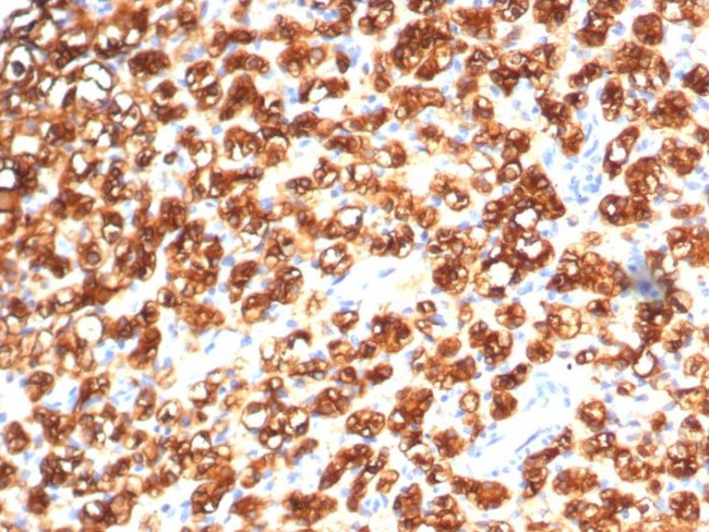 TPH1/Tryptophan Hydroxylase 1 Antibody in Immunohistochemistry (Paraffin) (IHC (P))