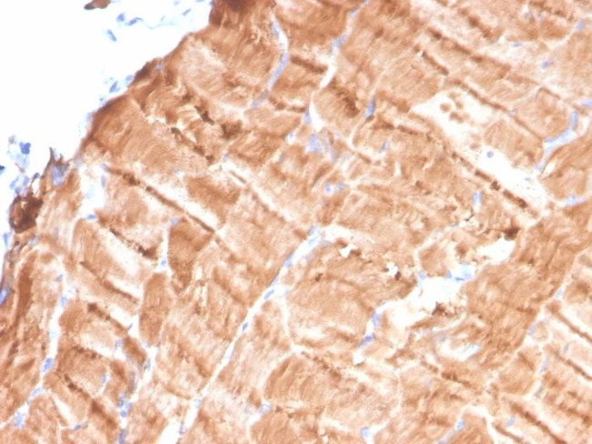 Tropomyosin, alpha-1 chain (striated muscle) Antibody in Immunohistochemistry (Paraffin) (IHC (P))