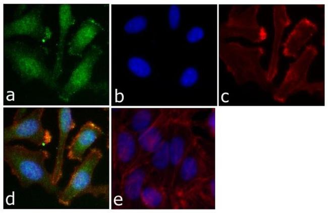 Phospho-STAT5 alpha (Tyr694) Antibody in Immunocytochemistry (ICC/IF)