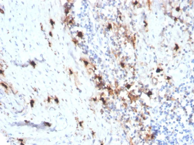 Tryptase (Mast Cell Marker) Antibody in Immunohistochemistry (Paraffin) (IHC (P))