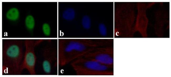 Phospho-STAT4 (Tyr693) Antibody in Immunocytochemistry (ICC/IF)