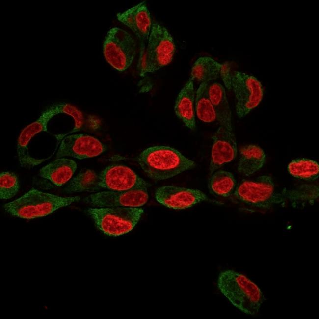 GRP94/HSP90B1 (Endoplasmic Reticulum Marker) Antibody in Immunocytochemistry (ICC/IF)