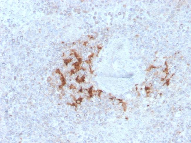 TRAF1 (TNFR-Associated Factor 1) (Lymphomatoid Papulosis Marker) Antibody in Immunohistochemistry (Paraffin) (IHC (P))