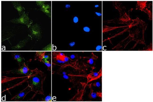 PAK1 Antibody in Immunocytochemistry (ICC/IF)