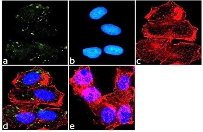 VEGF Receptor 1 Antibody in Immunocytochemistry (ICC/IF)