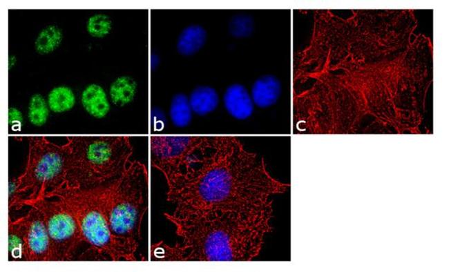 DVL2 Antibody in Immunocytochemistry (ICC/IF)