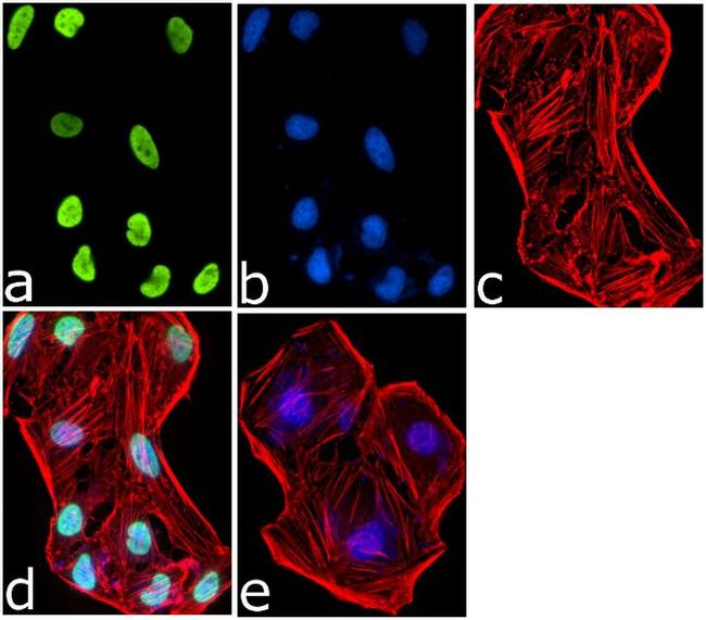 H2AK5ac Antibody in Immunocytochemistry (ICC/IF)