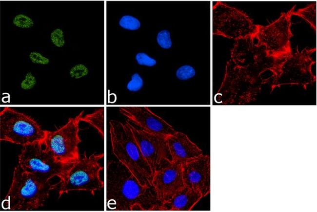 H4K20me2 Antibody in Immunocytochemistry (ICC/IF)