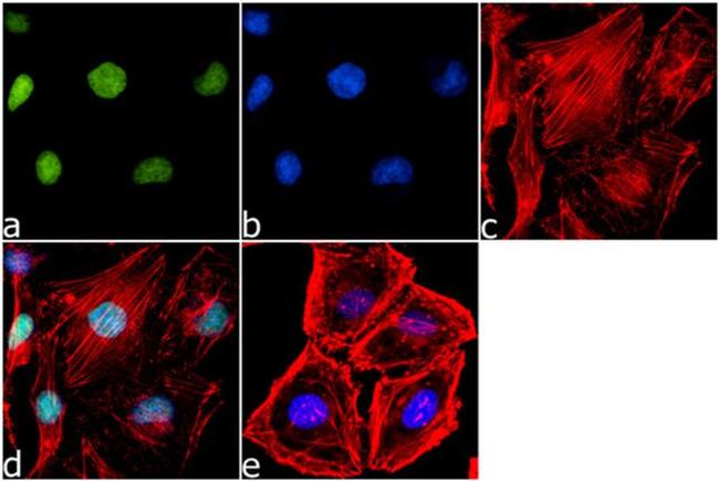 Btk Antibody in Immunocytochemistry (ICC/IF)