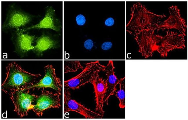 PRMT7 Antibody in Immunocytochemistry (ICC/IF)