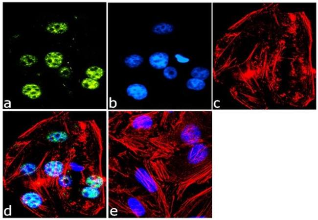 RNF20 Antibody in Immunocytochemistry (ICC/IF)