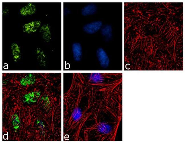 H2AK119ub Antibody in Immunocytochemistry (ICC/IF)