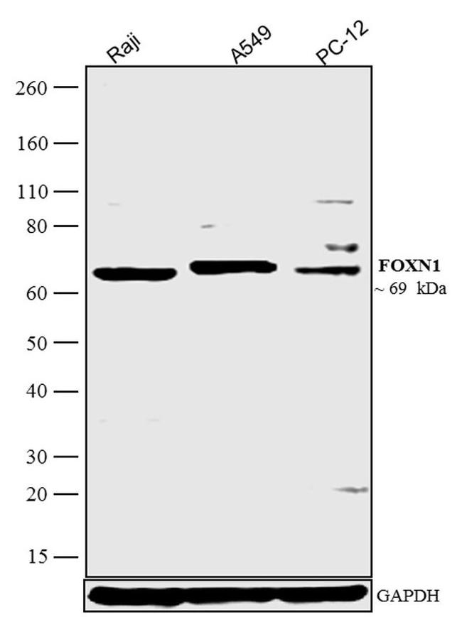 FOXN1 Antibody in Western Blot (WB)