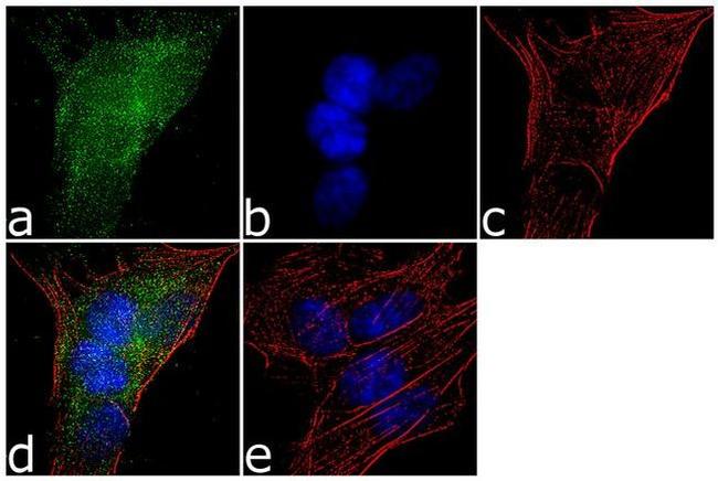 HTR2C Antibody in Immunocytochemistry (ICC/IF)