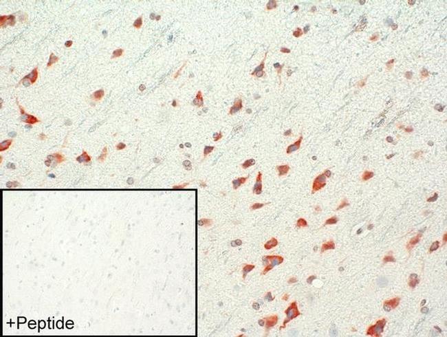 mGluR1 Antibody in Immunohistochemistry (IHC)