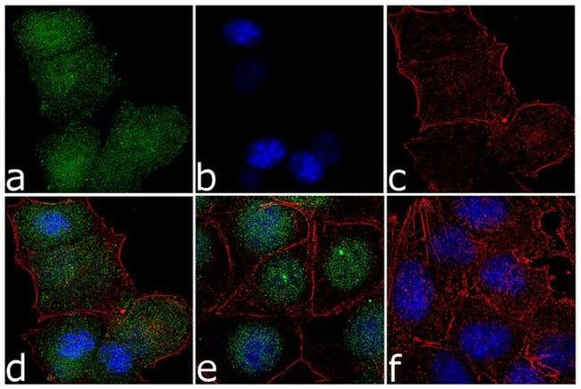 ERK5 Antibody in Immunocytochemistry (ICC/IF)