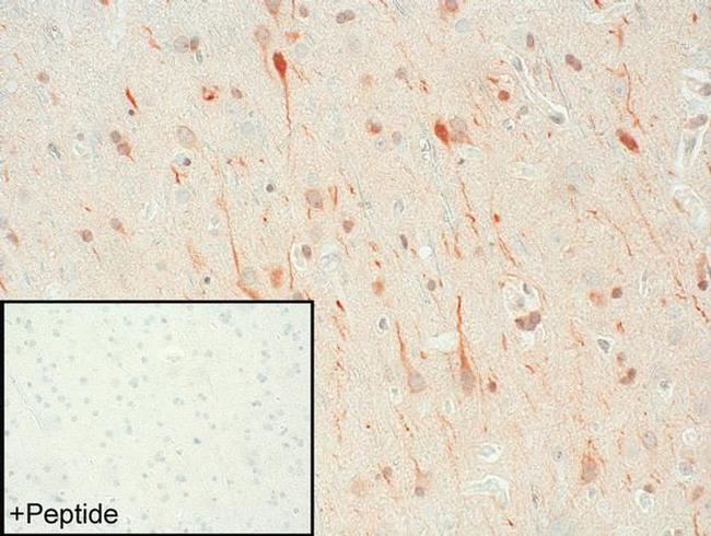 DRD1 Antibody in Immunohistochemistry (IHC)