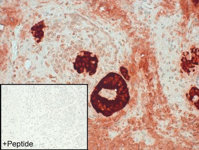 BDKRB2 Antibody in Immunohistochemistry (IHC)