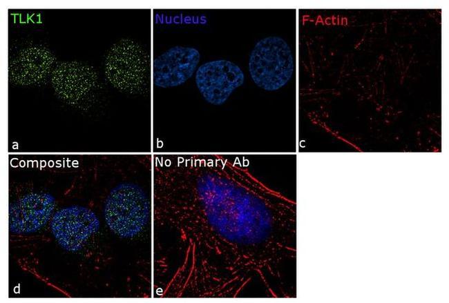 TLK1 Antibody in Immunocytochemistry (ICC/IF)