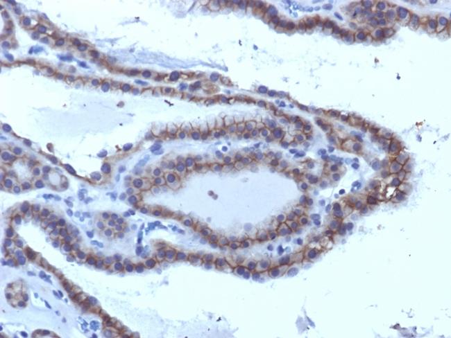 TSH-Receptor, A-Chain (Thyroid Marker) Antibody in Immunohistochemistry (Paraffin) (IHC (P))