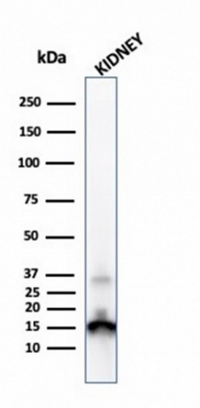 Transthyretin (Prealbumin) Antibody in Western Blot (WB)