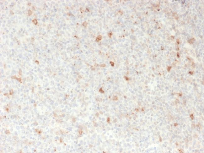 OX40/CD134/TNFRSF4 (Immuno-Oncology Target) Antibody in Immunohistochemistry (Paraffin) (IHC (P))