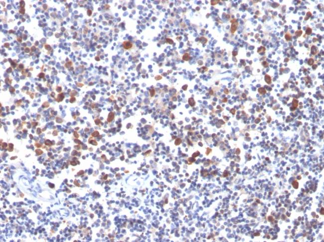 OX40/CD134/TNFRSF4 (Immuno-Oncology Target) Antibody in Immunohistochemistry (Paraffin) (IHC (P))