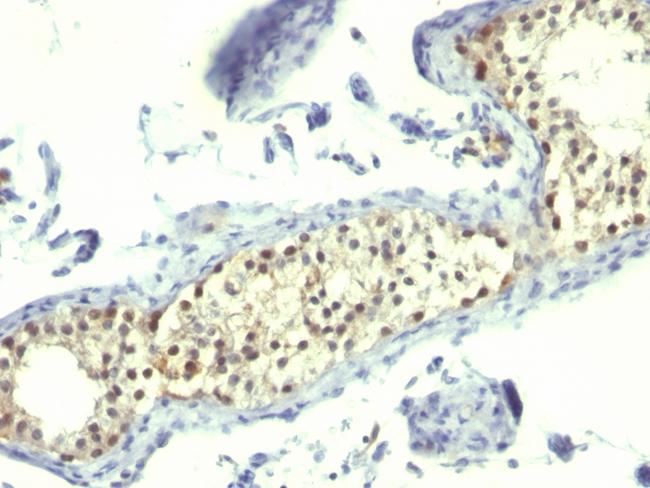 Thymidylate Synthase (5-FU Resistance Marker) Antibody in Immunohistochemistry (Paraffin) (IHC (P))