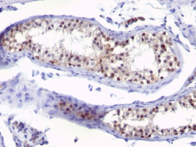 Thymidylate Synthase (5-FU Resistance Marker) Antibody in Immunohistochemistry (Paraffin) (IHC (P))