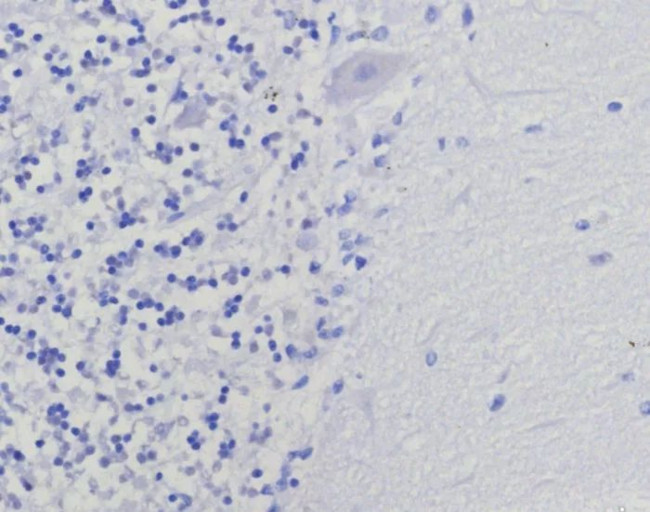 Thymidylate Synthase (5-FU Resistance Marker) Antibody in Immunohistochemistry (Paraffin) (IHC (P))