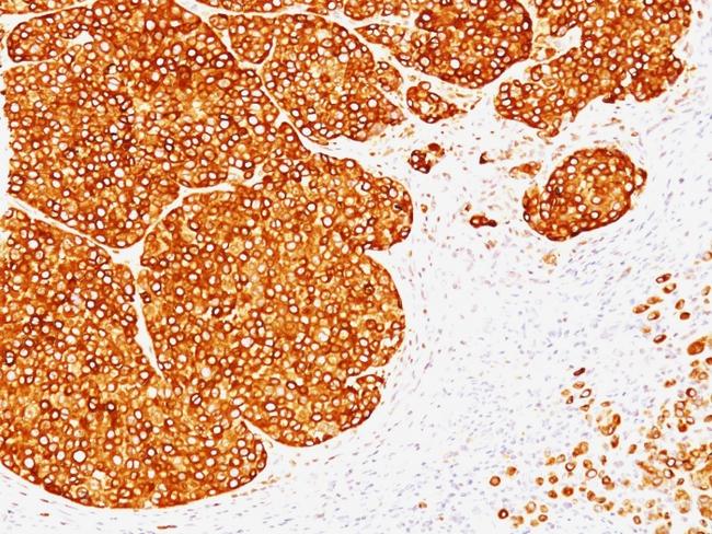 Tyrosinase (Melanoma Marker) Antibody in Immunohistochemistry (Paraffin) (IHC (P))