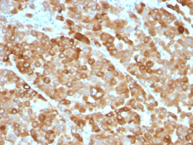 Tyrosinase (Melanoma Marker) Antibody in Immunohistochemistry (Paraffin) (IHC (P))