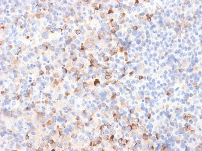 Tyrosinase Antibody in Immunohistochemistry (Paraffin) (IHC (P))