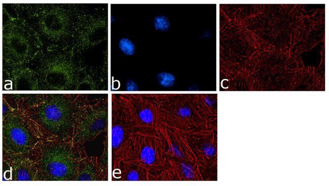 PRMT3 Antibody in Immunocytochemistry (ICC/IF)