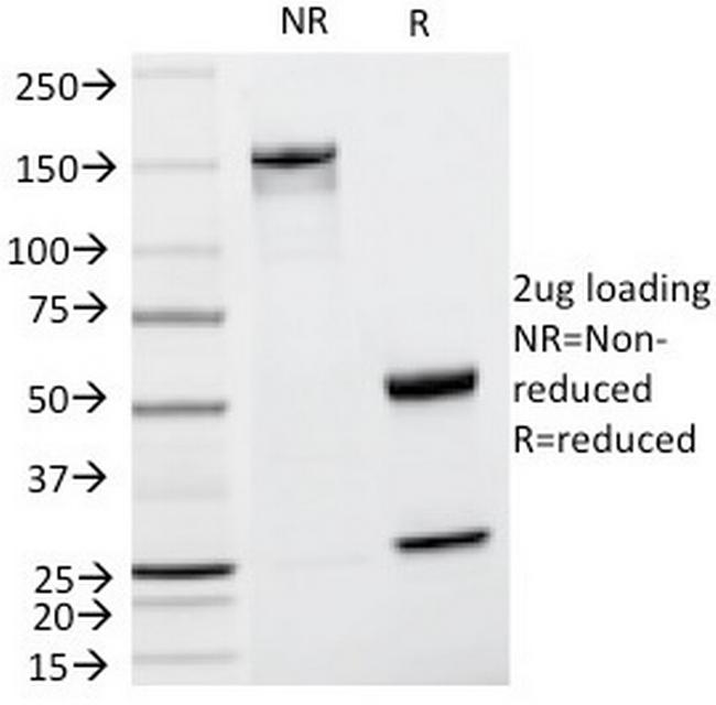 Tyrosinase-Related Protein-1 (TYRP-1) (Melanoma Marker) Antibody in SDS-PAGE (SDS-PAGE)