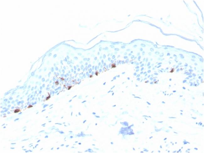 Tyrosinase-Related Protein-1 (TYRP-1) (Melanoma Marker) Antibody in Immunohistochemistry (Paraffin) (IHC (P))