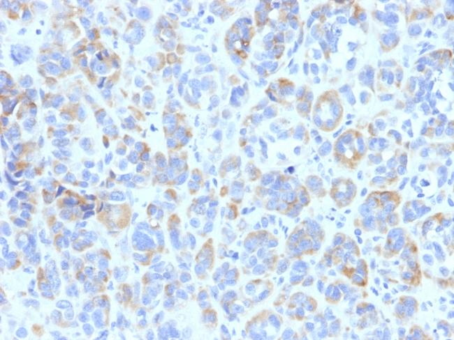 Tyrosinase-Related Protein-1 (TYRP-1) (Melanoma Marker) Antibody in Immunohistochemistry (Paraffin) (IHC (P))