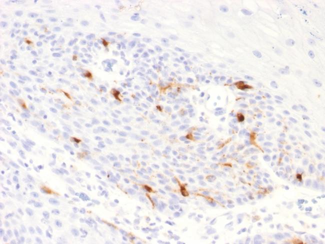 Tyrosinase-Related Protein-1 (TYRP-1) (Melanoma Marker) Antibody in Immunohistochemistry (Paraffin) (IHC (P))