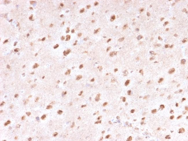 Ubiquitin Antibody in Immunohistochemistry (Paraffin) (IHC (P))