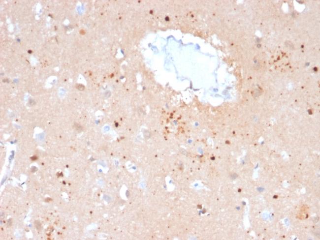 Ubiquitin (Autophagy Marker) Antibody in Immunohistochemistry (Paraffin) (IHC (P))