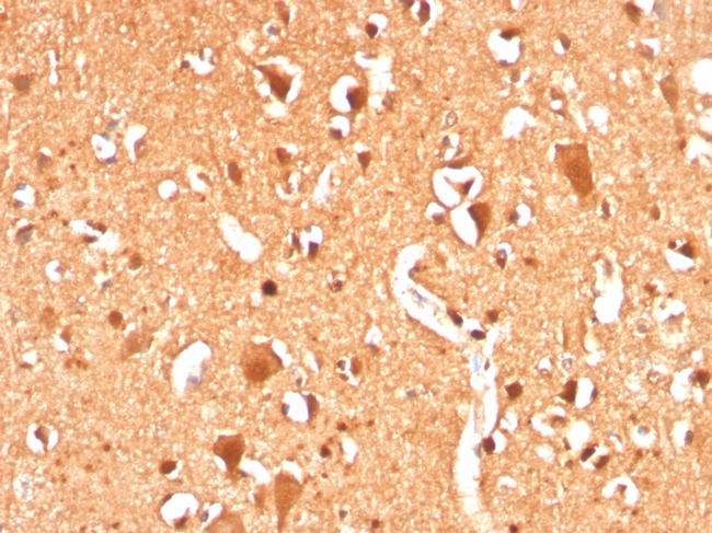 Ubiquitin Antibody in Immunohistochemistry (Paraffin) (IHC (P))